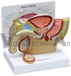 Male Pelvis cross-section including a testicle with cancer